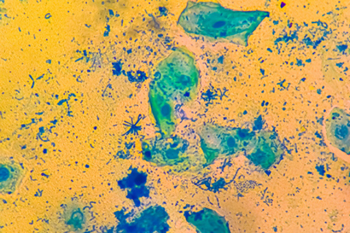 Bacterial cells chains, Streptococcus pyogenes-GettyImages-2161636013