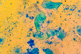 Bacterial cells chains, Streptococcus pyogenes-GettyImages-2161636013