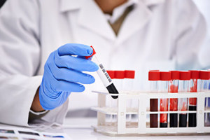 GettyImages-529157187-blood sample-vial-hemotology
