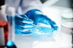 GettyImages-2176475781-petri-dish-scientist-gloves-microbial