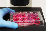 Development Of A High Sensitivity SPE-LC-MS/MS Assay GettyImages-1602744313 assay