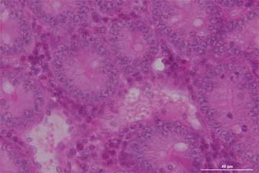 Hematoxylin And Eosin Stained Tissue