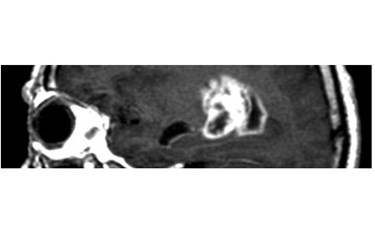 Brain-scan-Cropped-445x124 Brain-scan-Cropped-445x124