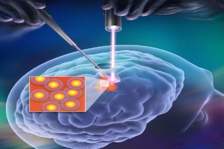 Handheld Scanner Could Make Brain Tumor Removal More Complete Reducing ...