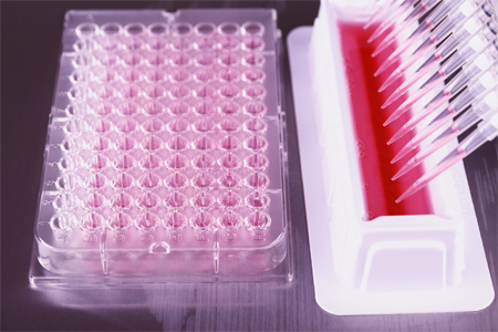 rAAV Production Using HEK293 Cell Line And Transfection Medium - Vimarsana News