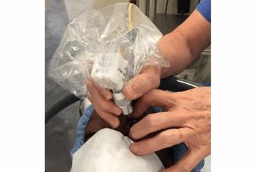 Handheld OCT 4 Handheld OCT 4