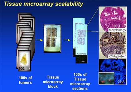 AACR Report: Tissue Chips Bear Fruit