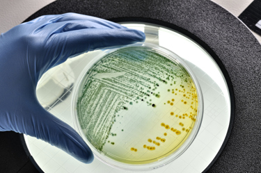 E.coli bacteria growing in dish