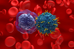 CAR T cell therapy, Acute myeloid leukaemia AML-GettyImages-2176871062