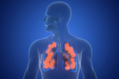 Human Respiratory System Lungs with Alveoli Anatomy-GettyImages-2222676998