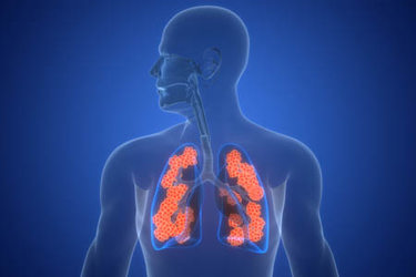 Human Respiratory System Lungs with Alveoli Anatomy-GettyImages-2222676998