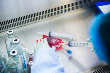 GettyImages-2213666852-fluid-handling-laboratory-syringe-gloves GettyImages-2213666852-fluid-handling-laboratory-syringe-gloves