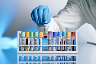 Test Tube Blood Samples GettyImages-177440807