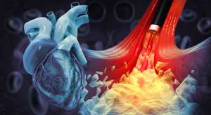 Biophotonics Cardiovascular Disease GettyImages-1356347332