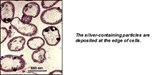 Silver-Packing Bacteria Silver-Packing Bacteria