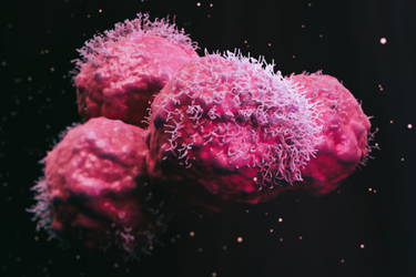 Cancer Malignant cells-GettyImages-1372020529 Cancer Malignant cells-GettyImages-1372020529