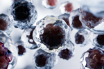 metastasis Growing tumor, viruses and bacteria, abnormal white blood cells, cancer-GettyImages-2211610742