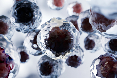 metastasis Growing tumor, viruses and bacteria, abnormal white blood cells, cancer-GettyImages-2211610742 metastasis Growing tumor, viruses and bacteria, abnormal white blood cells, cancer-GettyImages-2211610742