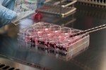 Researchers Convert Skin Cells To Replace HD-Damaged Brain Cells Stem cell cultures