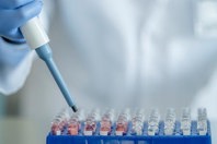 The New Annex 1 Regulations – Why Is It Important And How Can We Help? GettyImages-1266320932 syringe, filling, lab