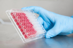Laboratory samples-GettyImages-1746464234