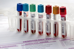 tubes with blood samples, hematology test-GettyImages-1443027500