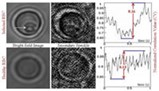 Detecting-Malaria-Early-Sma