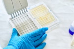 In Vitro/In Vivo Permeability: A 4-Cell Line Study Multi pipette, sample preparation, bioassay, in vitro cell-GettyImages-2058885436