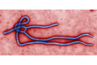ebola_virus_virion