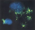 News from ASCB: Centrosomes may provide clues to cancer prognosis