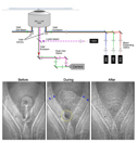 Cell lysis and TIRF - Dickinson-01