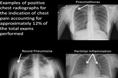 Positive X-rays
