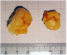 Pasta boiled together, rejected in a baby food process