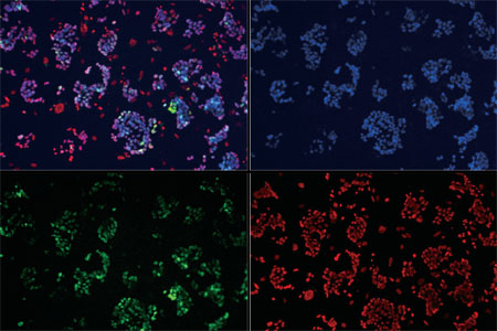 Automation Of Cell Staining