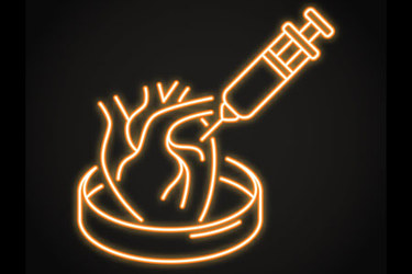 Human heart with syringe in Petri dish-GettyImages-2244277289