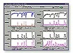 Electrochemical Signal Analyzer Electrochemical Signal Analyzer