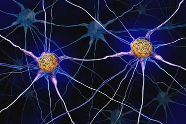 brain damage in Alzheimer’s disease-GettyImages-2236863702