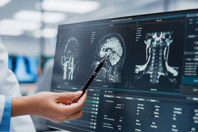 GettyImages-1388387927-computer-scans-brain-doctor-pen