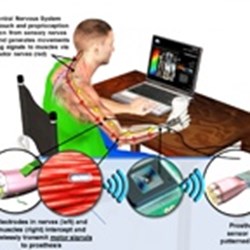 By Restoring A Sense Of Touch To Amputees HAPTIX Seeks To Overcome ...