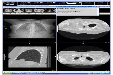 CoActiv EXAM-PACS Jacket w impression