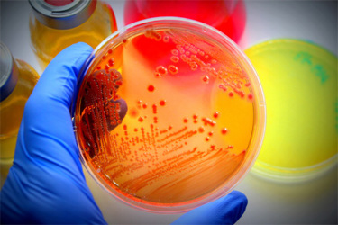 GettyImages-507526558-petri-dish-microbiology GettyImages-507526558-petri-dish-microbiology