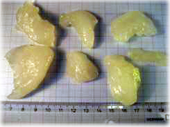 Lumps of starch rejected in a baby food process