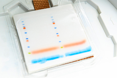 GettyImages-1323197495-western-blot-analysis