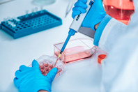 Enhancing Cell And Gene Therapy: The LVV Platform Advantage GettyImages-2163607311-scientist-assay-cell-culture-laboratory-gloves