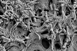 SEM of biofilm inside a shower hose