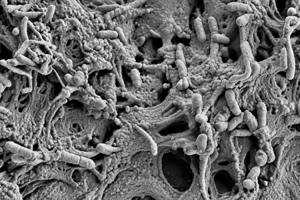 SEM of biofilm inside a shower hose