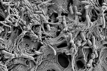SEM of biofilm inside a shower hose SEM of biofilm inside a shower hose