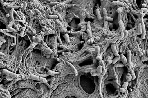 SEM of biofilm inside a shower hose