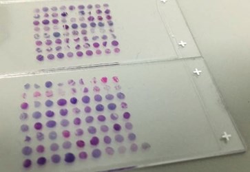 tissue microarray (TMA) tissue microarray (TMA)