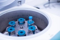 Conquering Challenges In Viral Vector Production GettyImages-1425355912-laboratory-centrifuge-vial-samples